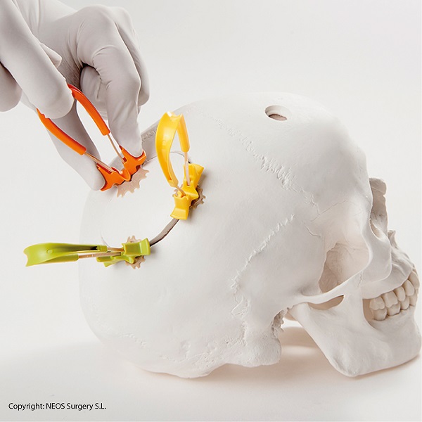 Medical CMF Neos Cranial Loop