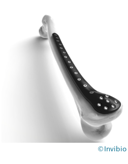 bone-implant